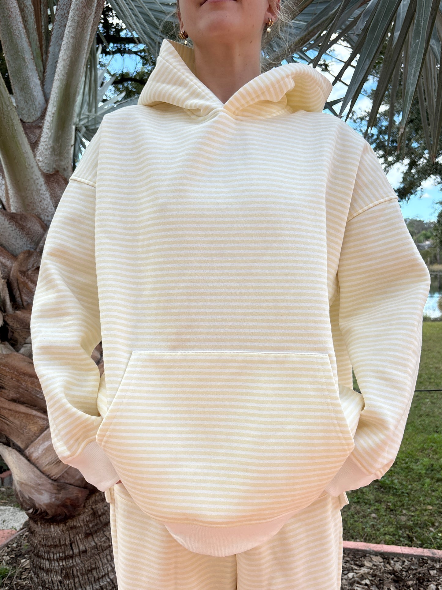 Baby Yellow and White Big Striped Hoodie
